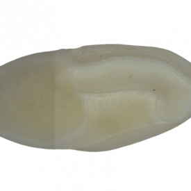Otólito de pescadinha-branca